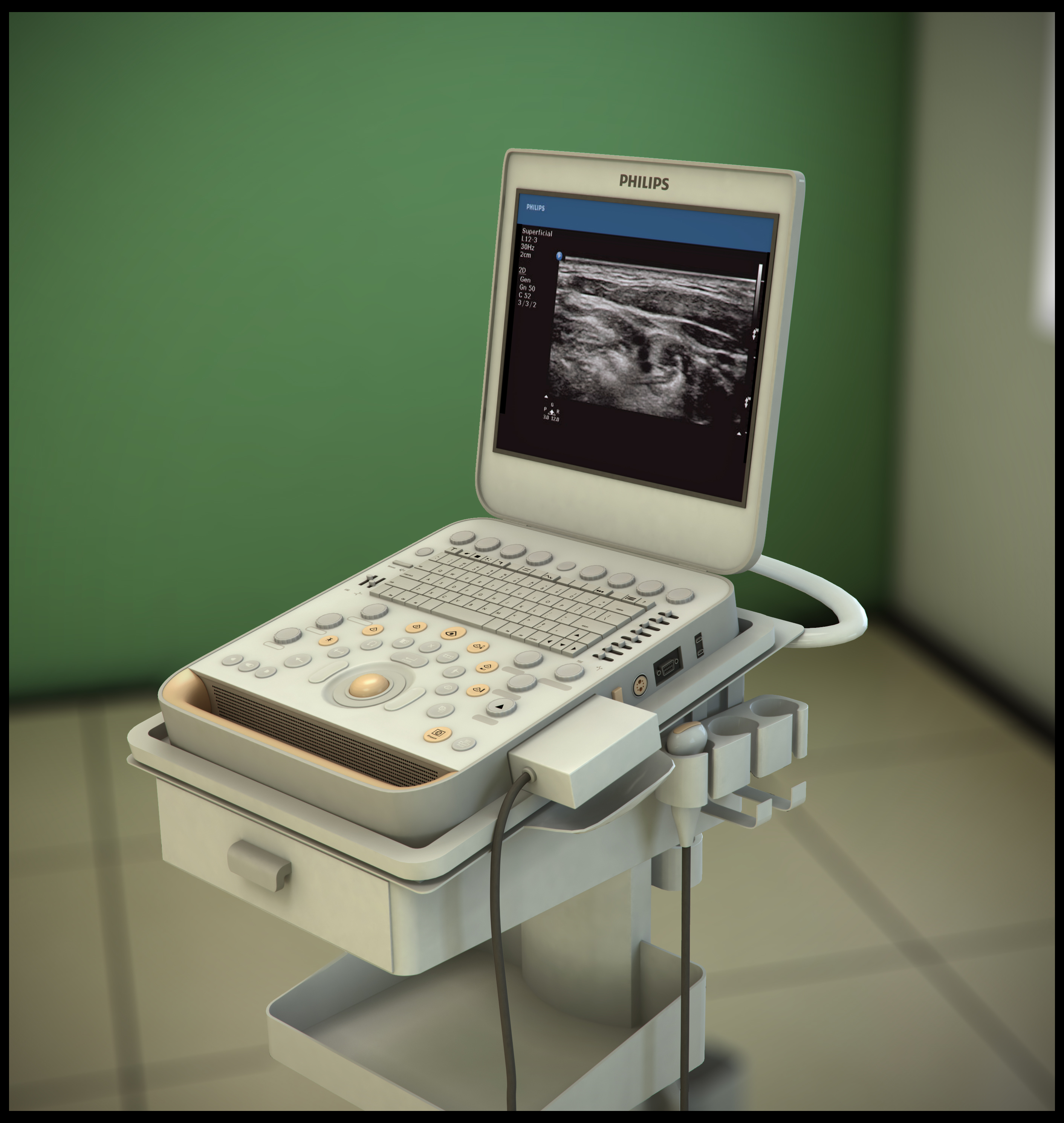 philips cx50 ultrasound