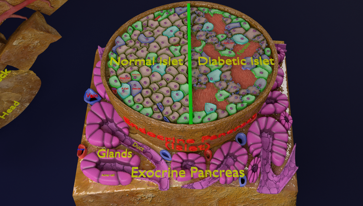 糖尿病胰腺解剖显微镜胰岛β胰岛素3d模型