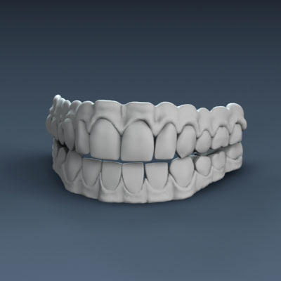 牙龈3d模型