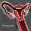 uterus cross section ovaries 3d model