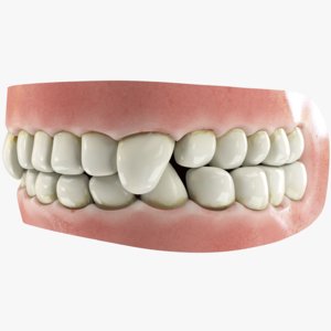 3D teeth gums tongue model
