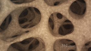 3D bone structure 360