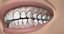 dental mouth 3D