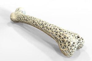 print femur bone human 3D model