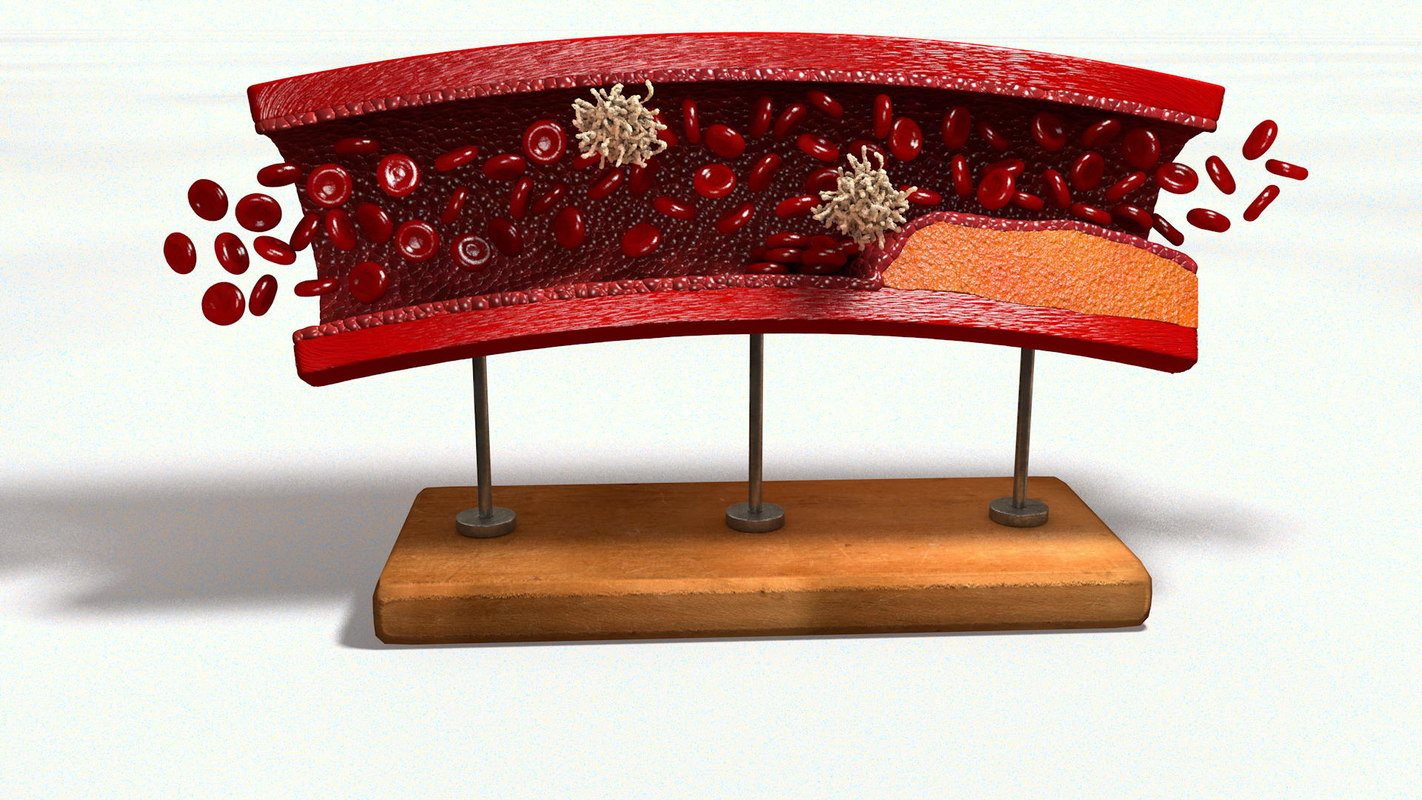 Модель сосуды. Модель сосуды. Модели сосудов резиновые. Модель сосуды. Макет сосуда.