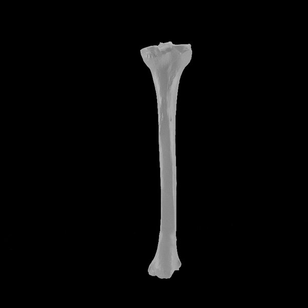 3D human tibia model - TurboSquid 1234604