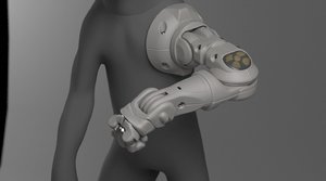 prosthetic arm 3D