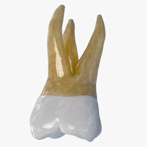 3D upper second molar