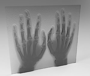 xray hand human bones 3D
