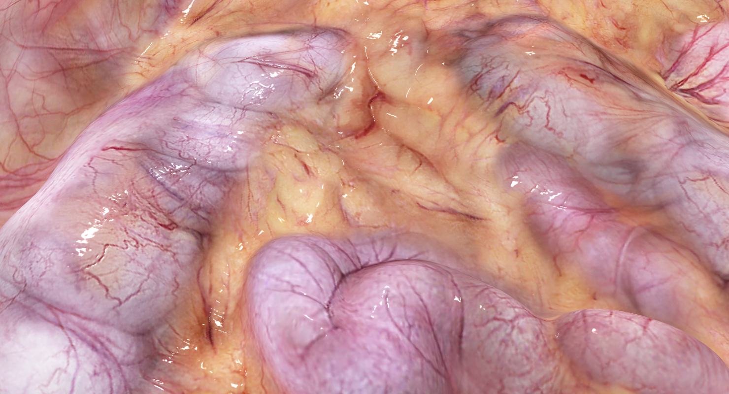 3D abdominal cavity model - TurboSquid 1289299