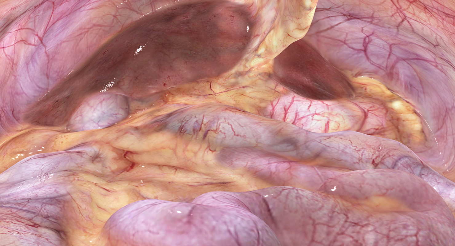 3D abdominal cavity model - TurboSquid 1289299