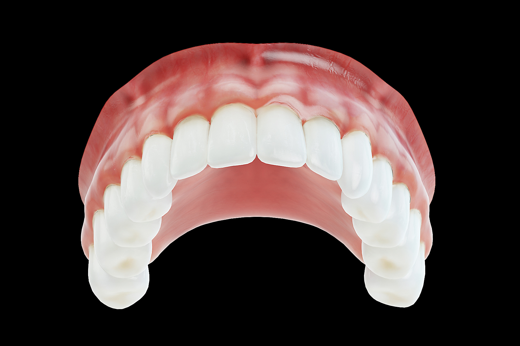 假牙3d模型