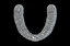 3D human dentures