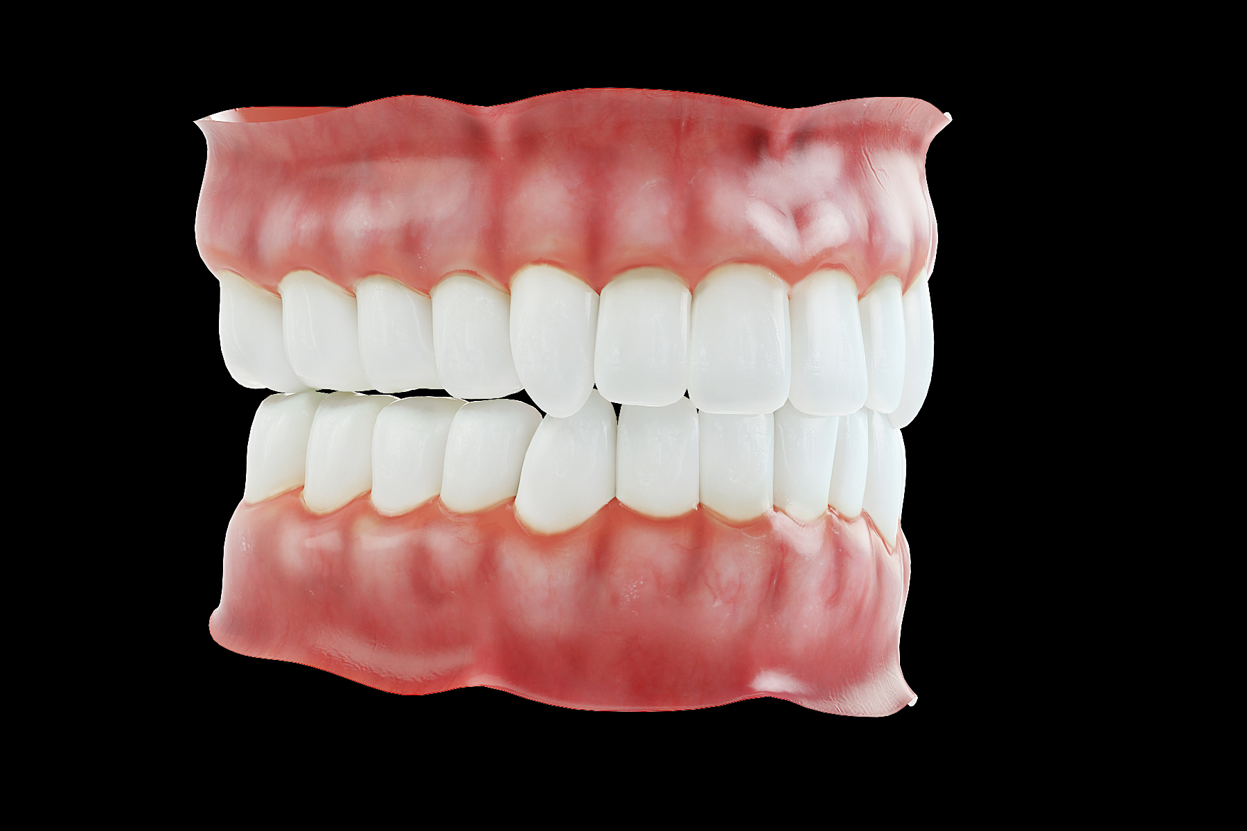 假牙3d模型