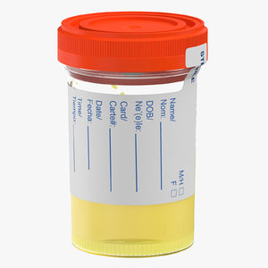 3D urine sample half