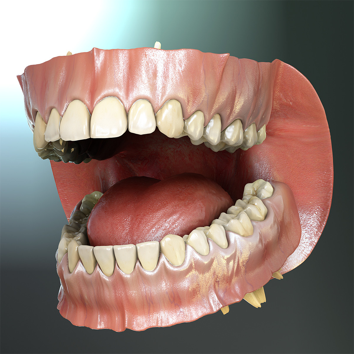 3d model orthodontics mouth teeth