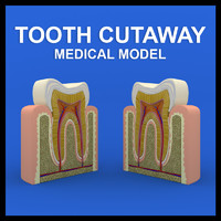 Tooth Cutaway