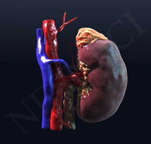 kidney 3d lwo