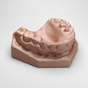 dental cast 3ds