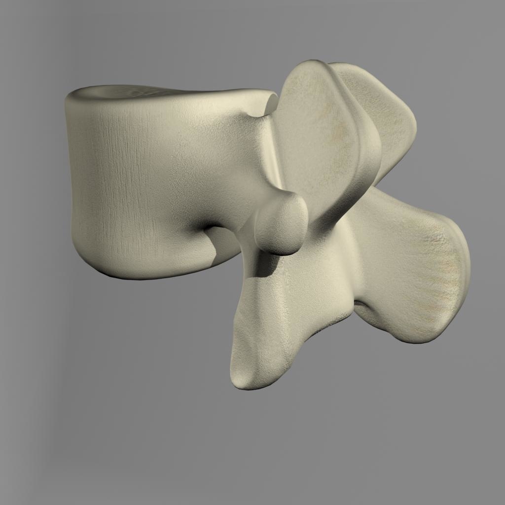 3d Lumbar Vertebrae Model