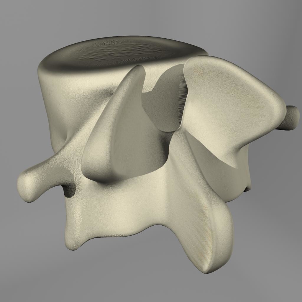 3d Lumbar Vertebrae Model