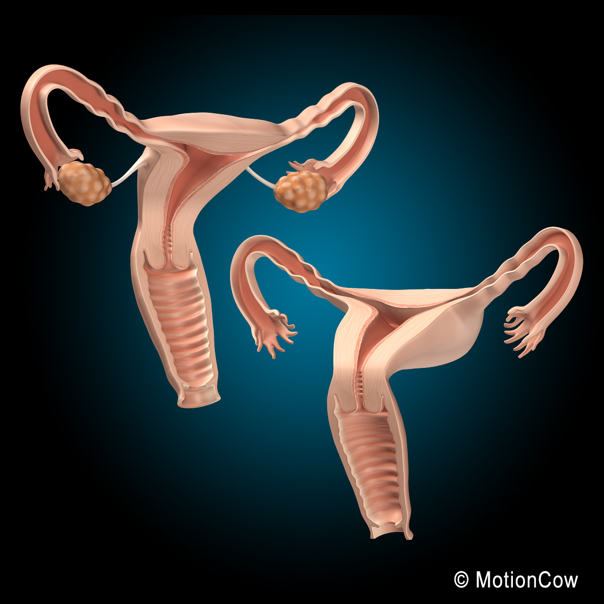 3d female uterus model