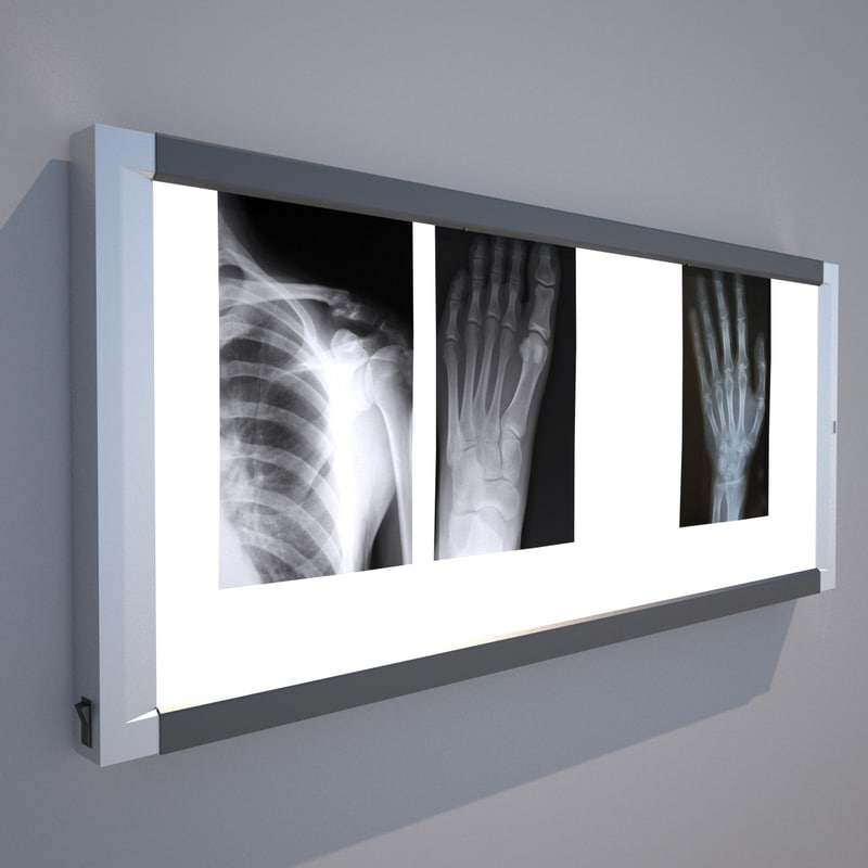 xray light box dwg
