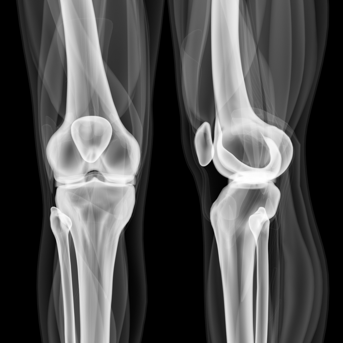 3d anatomically correct knee model