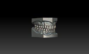 3d dental impressions model
