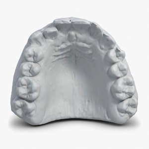 3d model gypsum mould teeth scan