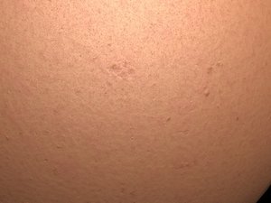Procedural Human Skin