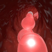 Blood flow - Collection