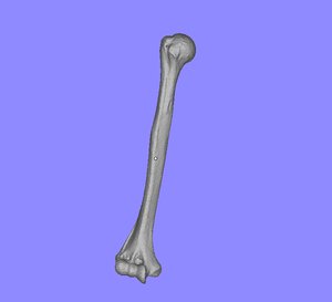 3ds humerus ct scan