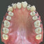 realistic orthodontic anatomy mouth max