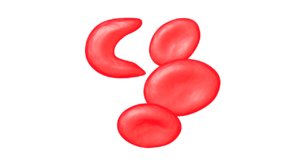 maya sickle cell anemia