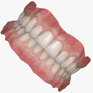realistic orthodontics medicine 3d model