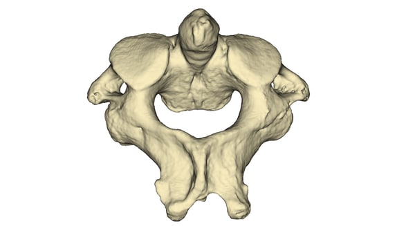 Menschlicher C2 Wirbel Die Achse 3d Modell Turbosquid 929487