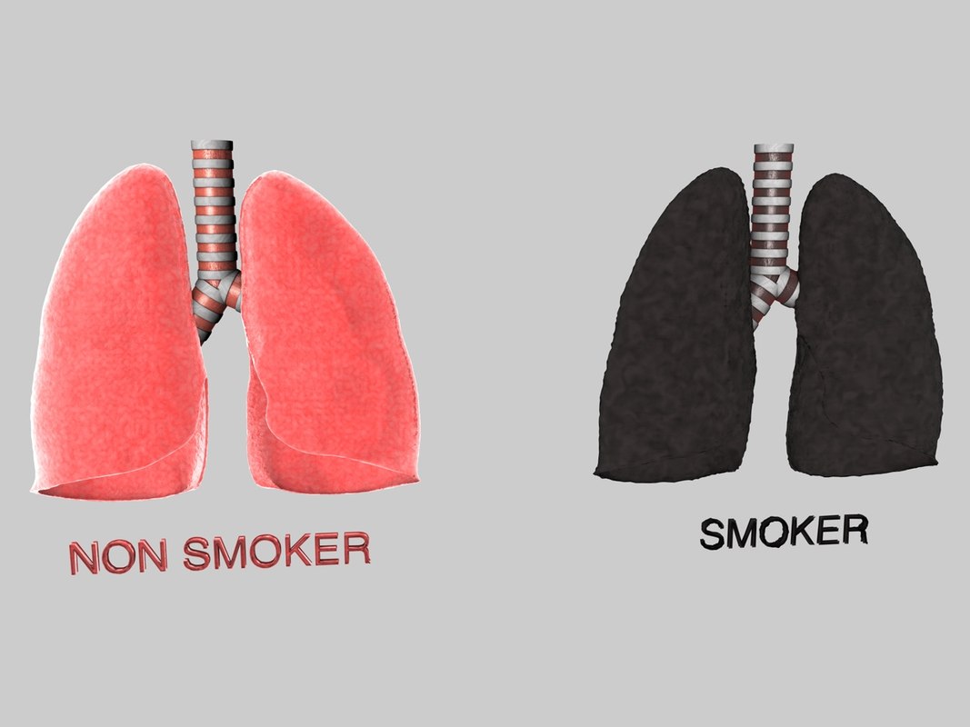 Лёгкие курильщика макет