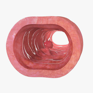 polyp digestive 3d model