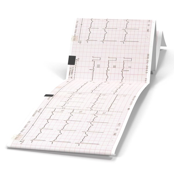 electrocardiograph report paper form max
