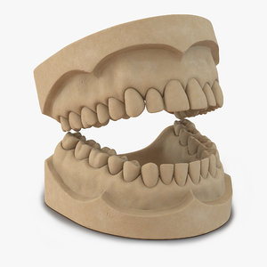 3d dental mold model