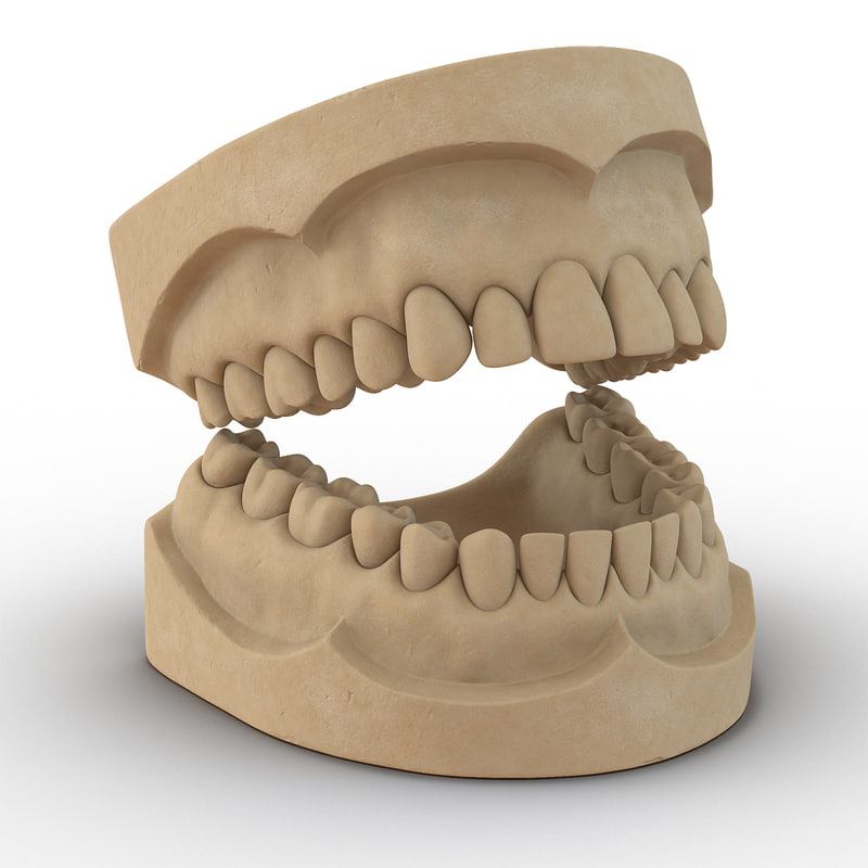 3d dental mold model