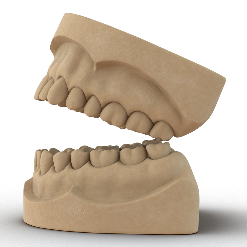 3d dental mold model