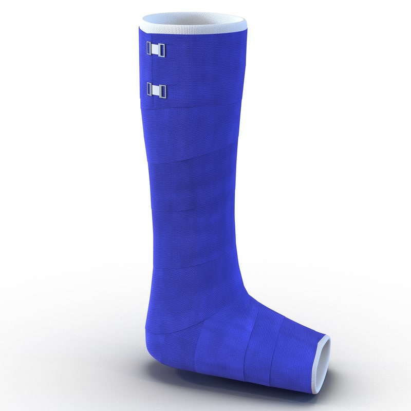max blue fiberglass cast leg