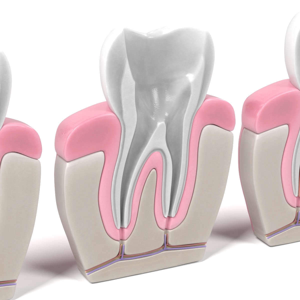 3d root canal procedure