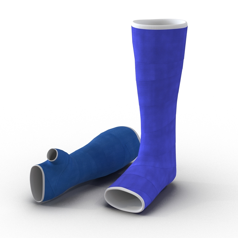 3d model blue fiberglass cast arm