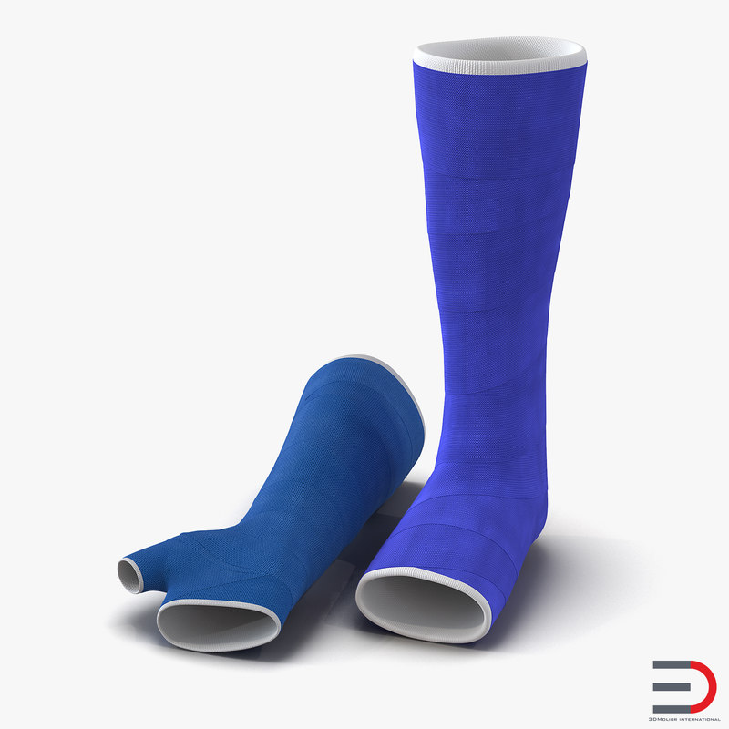 3d model blue fiberglass cast arm