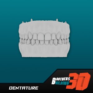 3d model dentature