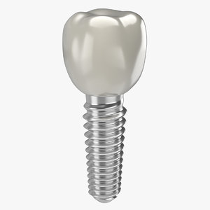 tooth implant obj