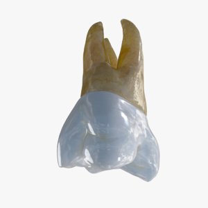 upper molar 3D